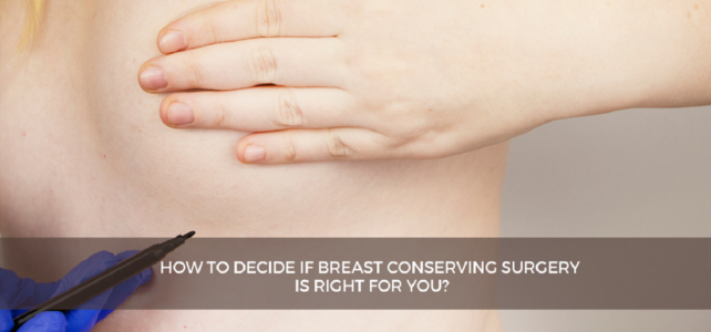 How to decide if breast conserving surgery is right for you?