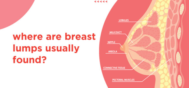 Where are breast lumps usually found?